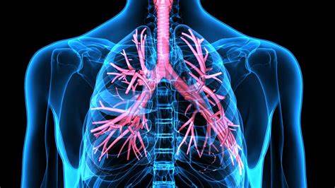 Bronchial Asthma