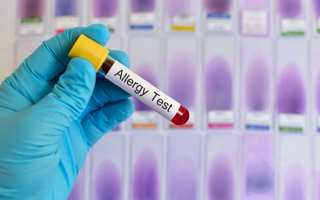 Allergy Blood Test: Fast & Accurate Diagnosis for Effective Relief